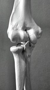 A detailed black and white view of the human knee joint anatomical model showcasing bone and ligament structures.